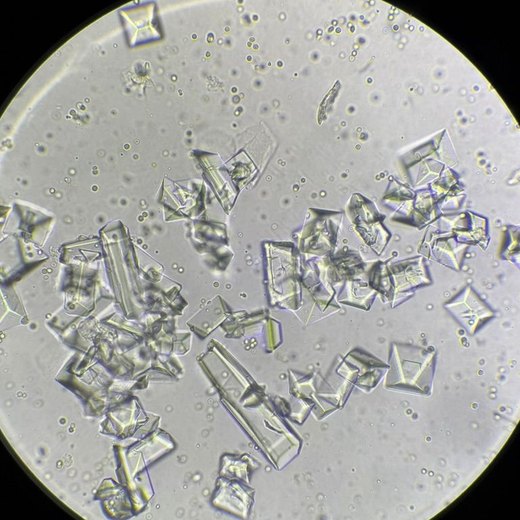 Uroanálisis