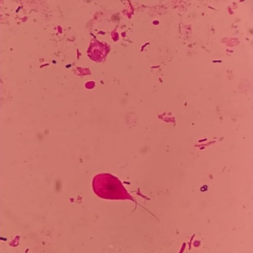 Parasitología